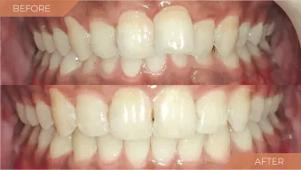 case-1-before-after