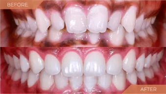 case-4-before-after