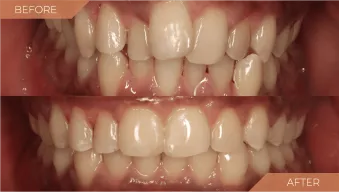 case-2-before-after