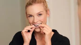 woman wearing a black shirt is putting spark aligners on.