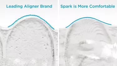 See Why 100% Of Patients Would Recommend Spark Aligners To A