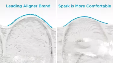 Spark Aligners is more comfortable