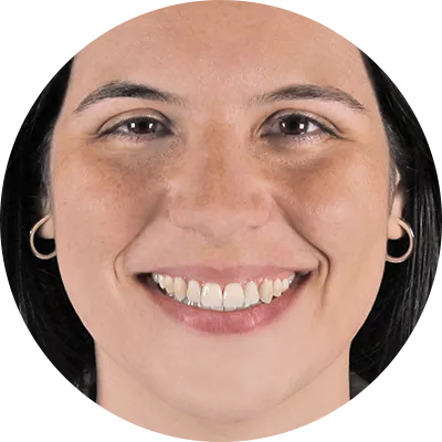 Patient journey Open Bite profile