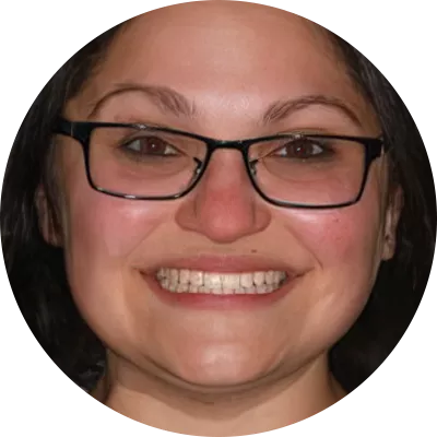 Patient journey Underbite profile