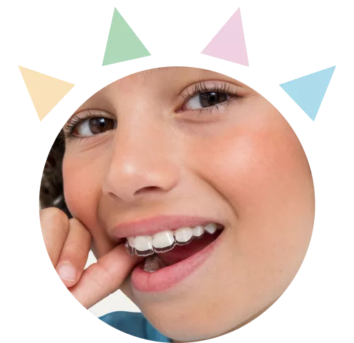 Smiling boy putting on Spark Junior clear aligners, showcasing the discreet and comfortable* orthodontic treatment for kids.