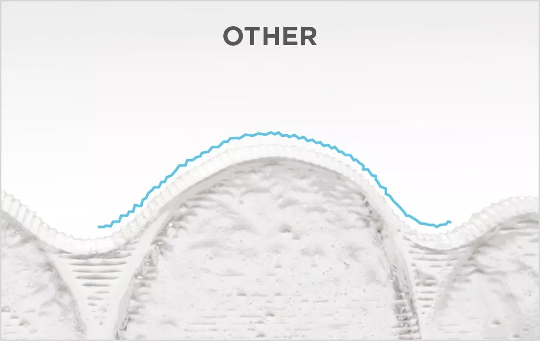 Spark Aligners are more comfortable than other