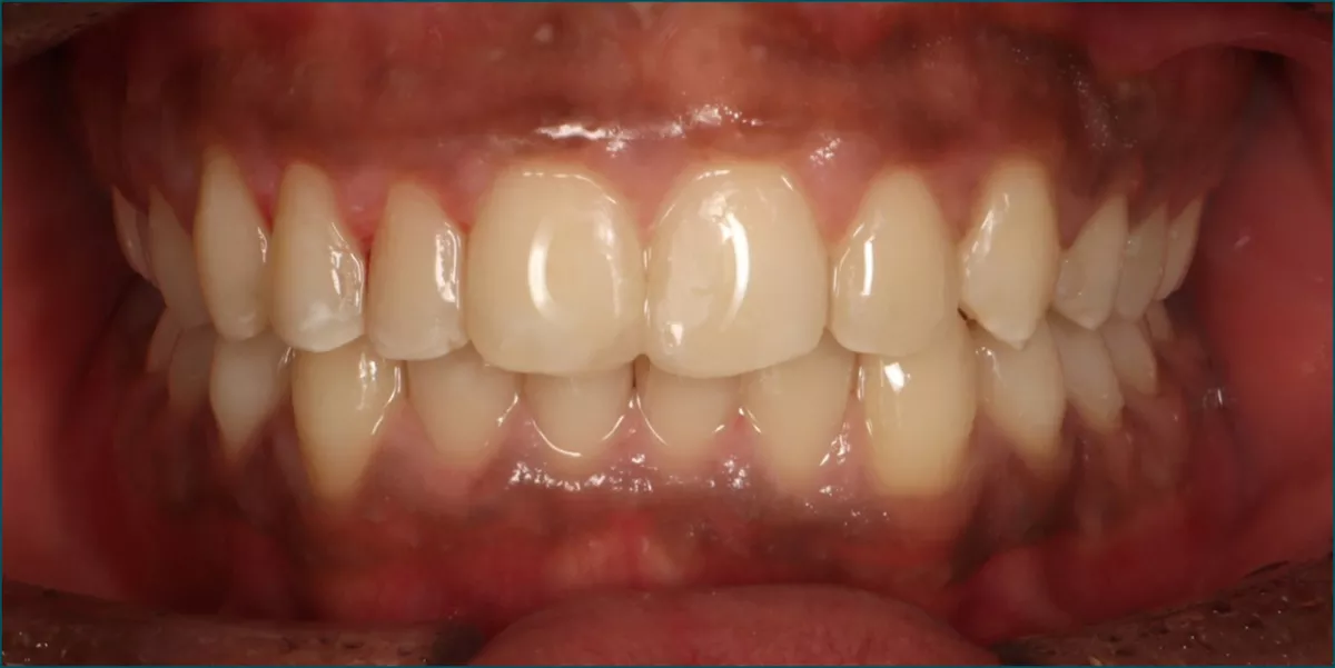 Picture1